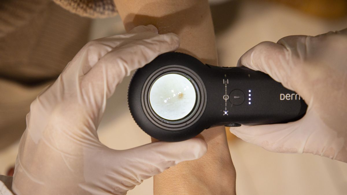 Lidem v lékárnách kontrolovali kůži. A každého třetího odeslali k lékaři